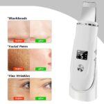 Ultrasonic Skin Perfector | 3-in-1 Deep Pore Cleansing & Lifting Spatula - Image 3