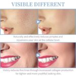 Pro-Glow High Frequency Wand | 4-in-1 Clinical Electrotherapy System for Acne & Anti-Aging