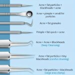 Professional 8-Piece Deep Pore Cleansing Kit | Stainless Steel Skincare Set - Image 5